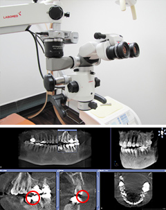 マイクロスコープと歯科用CTのイメージ画像