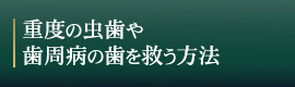 重度の虫歯や歯周病の歯を救う方法